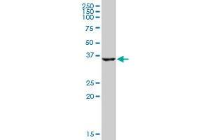 HSD17B2 MaxPab polyclonal antibody. (HSD17B2 抗体  (AA 1-387))