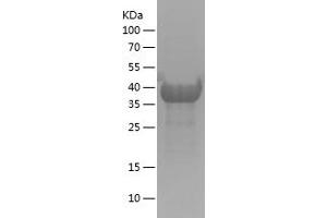 Western Blotting (WB) image for BCL2/adenovirus E1B 19kDa Interacting Protein 3-Like (BNIP3L) (AA 3-103) protein (His tag) (ABIN7121990) (BNIP3L/NIX Protein (AA 3-103) (His tag))