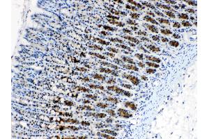 IHC analysis of CD166/ALCAM using anti- CD166/ALCAM antibody . (CD166 抗体  (AA 167-406))