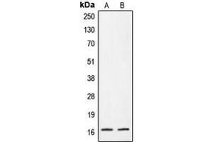 Western blot analysis of CRABP2 expression in A431 (A), HeLa (B) whole cell lysates. (CRABP2 抗体  (Center))