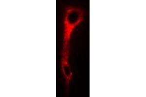 Immunofluorescent analysis of SNAP-gamma staining in U2OS cells. (NAPG 抗体)