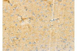 ABIN6258722 and ABIN6274757 at 1/100 staining Rat brain tissue by IHC-P. (RPS4Y1 抗体  (C-Term))
