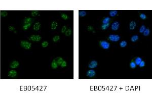 Immunofluorescence staining of MCF7 cells with 5ug/ml ABIN184743 antibody.