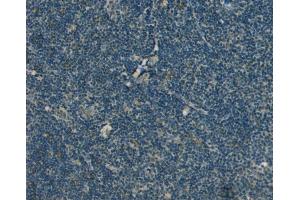 Immunohistochemistry (IHC) image for anti-RAN, Member RAS Oncogene Family (RAN) (N-Term) antibody (ABIN185256)