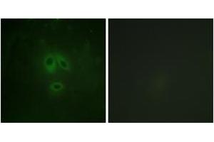 Immunofluorescence analysis of HeLa cells, using n-NOS (Phospho-Ser852) Antibody. (NOS1 抗体  (pSer852))