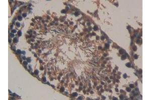 Immunohistochemistry (IHC) image for anti-Collagen, Type I, alpha 1 (COL1A1) (AA 1225-1453) antibody (ABIN7431647)