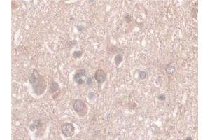 Detection of Nesp2 in Human Cerebrum Tissue using Polyclonal Antibody to Nesprin 2 (Nesp2) (SYNE2 抗体  (AA 6-296))