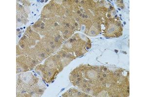 Immunohistochemistry of paraffin-embedded Human stomach using FLT3 Polyclonal Antibody (FLT3 抗体)