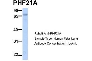 Host:  Rabbit  Target Name:  PHF21A  Sample Type:  Human Fetal Lung  Antibody Dilution:  1. (PHF21A 抗体  (N-Term))