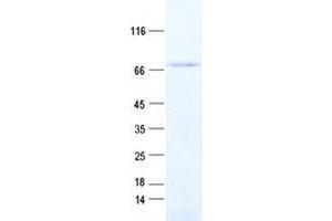 Western Blotting (WB) image for Zinc Finger, HIT-Type Containing 6 (ZNHIT6) protein (His tag) (ABIN2736145)