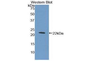 Western Blotting (WB) image for anti-Myeloproliferative Leukemia Virus Oncogene (MPL) (AA 311-460) antibody (ABIN1859873) (MPL 抗体  (AA 311-460))