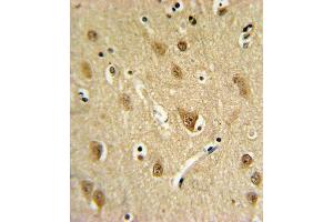 ST8SIA4 Antibody (Center) (ABIN653728 and ABIN2843035) IHC analysis in formalin fixed and paraffin embedded brain tissue followed by peroxidase conjugation of the secondary antibody and DAB staining. (ST8SIA4 抗体  (AA 186-214))