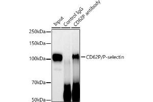 Immunoprecipitation analysis of 600 μg extracts of Mouse spleen cells using 3 μg CD62P/P-selectin antibody (ABIN7270190). (P-Selectin 抗体)