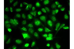 Immunofluorescence analysis of A549 cells using BIRC2 antibody. (BIRC2 抗体  (AA 1-300))