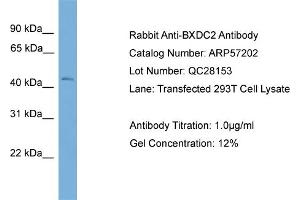 WB Suggested Anti-BXDC2  Antibody Titration: 0. (BRIX1 抗体  (Middle Region))