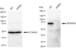 Western blotting analysis using RPS6KA1 antibody (ABIN7800229). (Recombinant RPS6KA1 抗体)