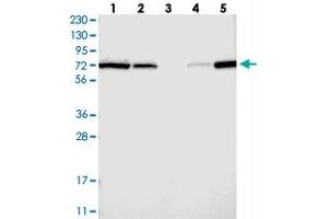 Western blot analysis of Lane 1: RT-4, Lane 2: U-251 MG, Lane 3: Human Plasma, Lane 4: Liver, Lane 5: Tonsil with AGPS polyclonal antibody  at 1:250-1:500 dilution.