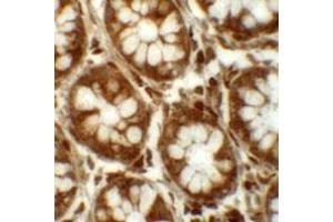 Immunohistochemical staining of human colon cells with LRRFIP2 polyclonal antibody  at 5 ug/mL.