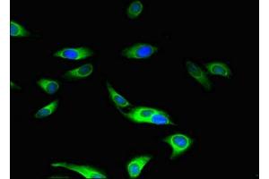 Immunofluorescent analysis of Hela cells using ABIN7160045 at dilution of 1:100 and Alexa Fluor 488-congugated AffiniPure Goat Anti-Rabbit IgG(H+L) (ASK1 抗体  (AA 363-431))