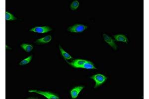 Immunofluorescent analysis of Hela cells using ABIN7160045 at dilution of 1:100 and Alexa Fluor 488-congugated AffiniPure Goat Anti-Rabbit IgG(H+L) (ASK1 抗体  (AA 363-431))