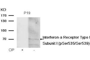 Western blot analysis of extracts from P19 cells, treated with calf intestinal phosphatase (CIP), using Interferon-a Receptor Type I Subunit I (phospho-Ser535/Ser539) Antibody. (IFNAR1 抗体  (pSer535, pSer539))