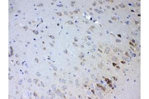IHC testing of FFPE rat brain tissue with IL15RA antibody at 1ug/ml. (IL15RA 抗体)