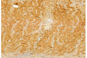 ABIN6260212 and ABIN6272874 at 1/100 staining Rat kidney tissue by IHC-P. (BBS5 抗体  (C-Term))