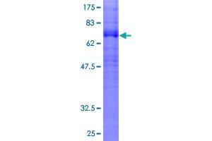 Image no. 1 for Cannabinoid Receptor 1 (CNR1) (AA 1-472) protein (GST tag) (ABIN1349880)