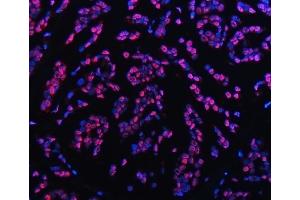 IF analysis of TRMT6 using anti-TRMT6 antibody (ABIN7602138). (TRMT6 抗体  (AA 6-489))