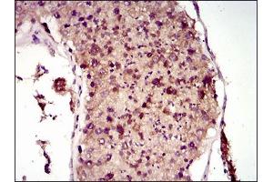 Immunohistochemical analysis of paraffin-embedded testis tissues using MAP1LC3A mouse mAb with DAB staining. (MAP1LC3A 抗体  (AA 1-121))