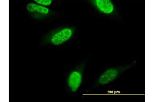 Immunofluorescence of monoclonal antibody to CARF on HeLa cell. (CDKN2AIP 抗体  (AA 1-579))