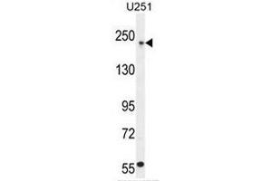 COL5A1 Antibody (N-term) western blot analysis in U251 cell line lysates (35µg/lane).
