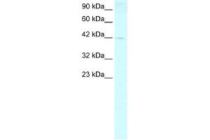 WB Suggested Anti-FOXP1 Antibody Titration:  0. (FOXP1 抗体  (N-Term))