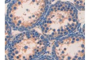 Detection of RETN in Mouse Testis Tissue using Monoclonal Antibody to Resistin (RETN) (Resistin 抗体  (AA 21-114))