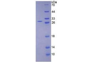 SDS-PAGE analysis of Human LOXL1 Protein. (LOXL1 蛋白)