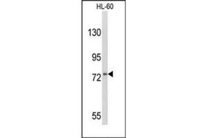 Western Blotting (WB) image for anti-Colony Stimulating Factor 3 Receptor (Granulocyte) (CSF3R) (AA 259-288), (Middle Region) antibody (ABIN951155)