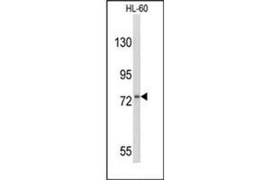 Western blot analysis of CD114 / CSF3R Antibody (Center) in HL-60 cell line lysates (35ug/lane). (CSF3R 抗体  (Middle Region))