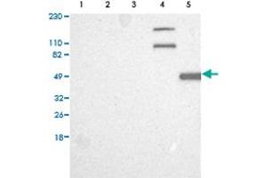 Western Blot analysis of (1) Human RT-4 cell, (2) Human U-251MG sp cell, (3) Human A-431 cell, (4) Human liver tissue, (5) Human tonsil tissue.