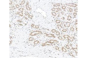 Immunohistochemistry (IHC) image for anti-AT Rich Interactive Domain 1B (SWI1-Like) (ARID1B) (AA 1425-1475) antibody (ABIN7795694) (Recombinant ARID1B 抗体  (AA 1425-1475))