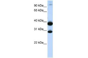 Western Blot showing ZNF138 antibody used at a concentration of 1-2 ug/ml to detect its target protein. (ZNF138 抗体  (C-Term))