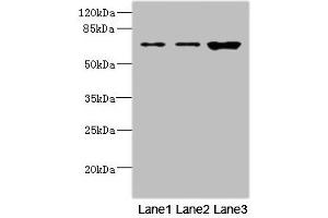 Western blot All lanes: SNX18 antibody at 1. (SNX18 抗体  (AA 449-628))