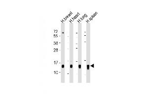 All lanes : Anti-S100A9 Antibody (Center) at 1:500-1:1000 dilution Lane 1: human breast lysate Lane 2: human heart lysate Lane 3: human lung lysate Lane 4: human spleen lysate Lysates/proteins at 20 μg per lane. (S100A9 抗体  (AA 22-56))
