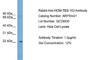 WB Suggested Anti-HOM-TES-103  Antibody Titration: 0. (IFFO1 抗体  (C-Term))