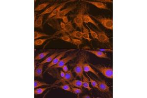 Immunofluorescence (IF) image for anti-Succinate Dehydrogenase Complex, Subunit B, Iron Sulfur (Ip) (SDHB) (AA 29-280) antibody (ABIN6147472)