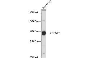 Western blot analysis of extracts of rat testis, using ZNF677 antibody (ABIN7271518) at 1:1000 dilution. (ZNF677 抗体  (AA 50-200))