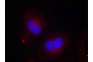Immunofluorescence staining of methanol-fixed Hela cells using FAK(Phospho-Tyr925) Antibody. (FAK 抗体  (pTyr925))
