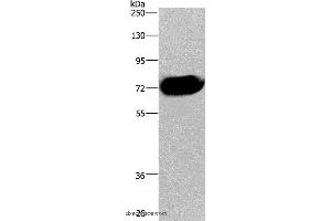 Western blot analysis of Human pancreas tissue, using CDC16 Polyclonal Antibody at dilution of 1:250 (CDC16 抗体)