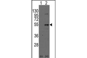 Western blot analysis of Dtnbpt(arrow) using rabbit polyclonal Dysbindin(Dtnbp1) Antibody (N-term) (ABIN389169 and ABIN2839335).