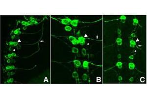 Image no. 1 for anti-Green Fluorescent Protein (GFP) antibody (FITC) (ABIN1101728)