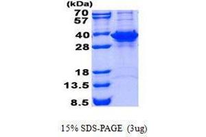 Figure annotation denotes ug of protein loaded and % gel used. (FN3KRP 蛋白)